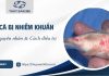Cá bị nhiễm khuẩn: Nguyên nhân và cách điều trị