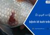 Bí quyết xử lý nhanh bệnh lở loét trên cá