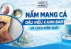 Nấm mang cá – Dấu hiệu cảnh báo và cách kiểm soát